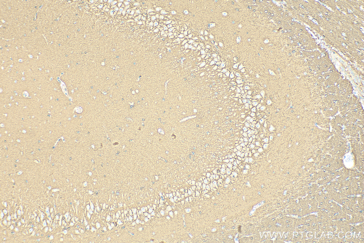 IHC staining of rat brain using RMX00061 IHC staining of rat brain using RMX00061