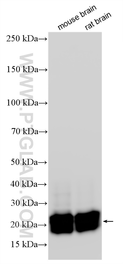 WB analysis using RMX00061 WB analysis using RMX00061