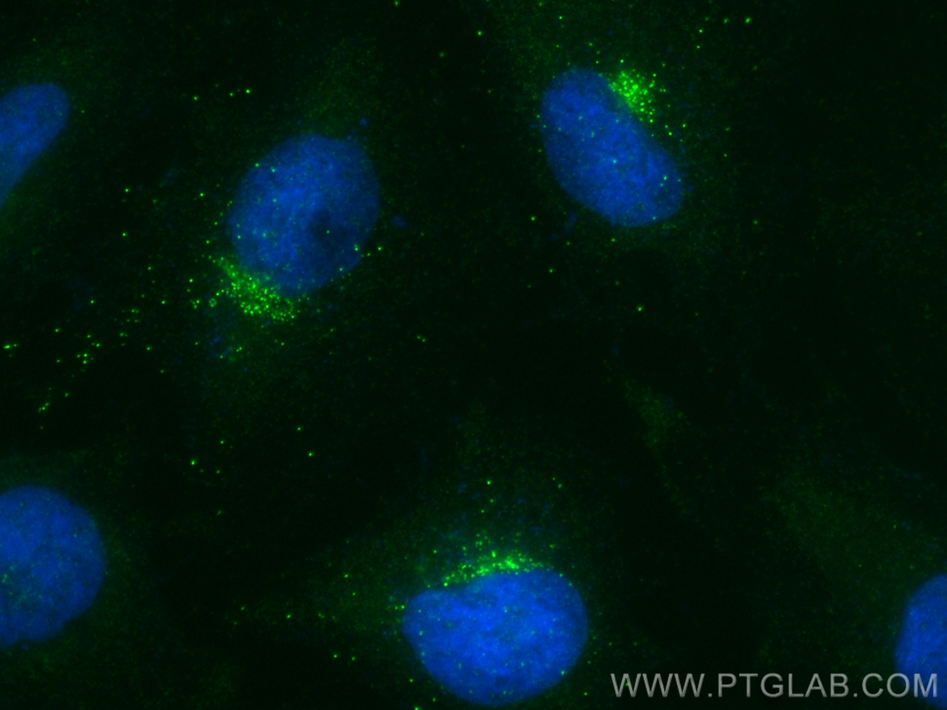 IF Staining of HeLa using 83342-1-RR