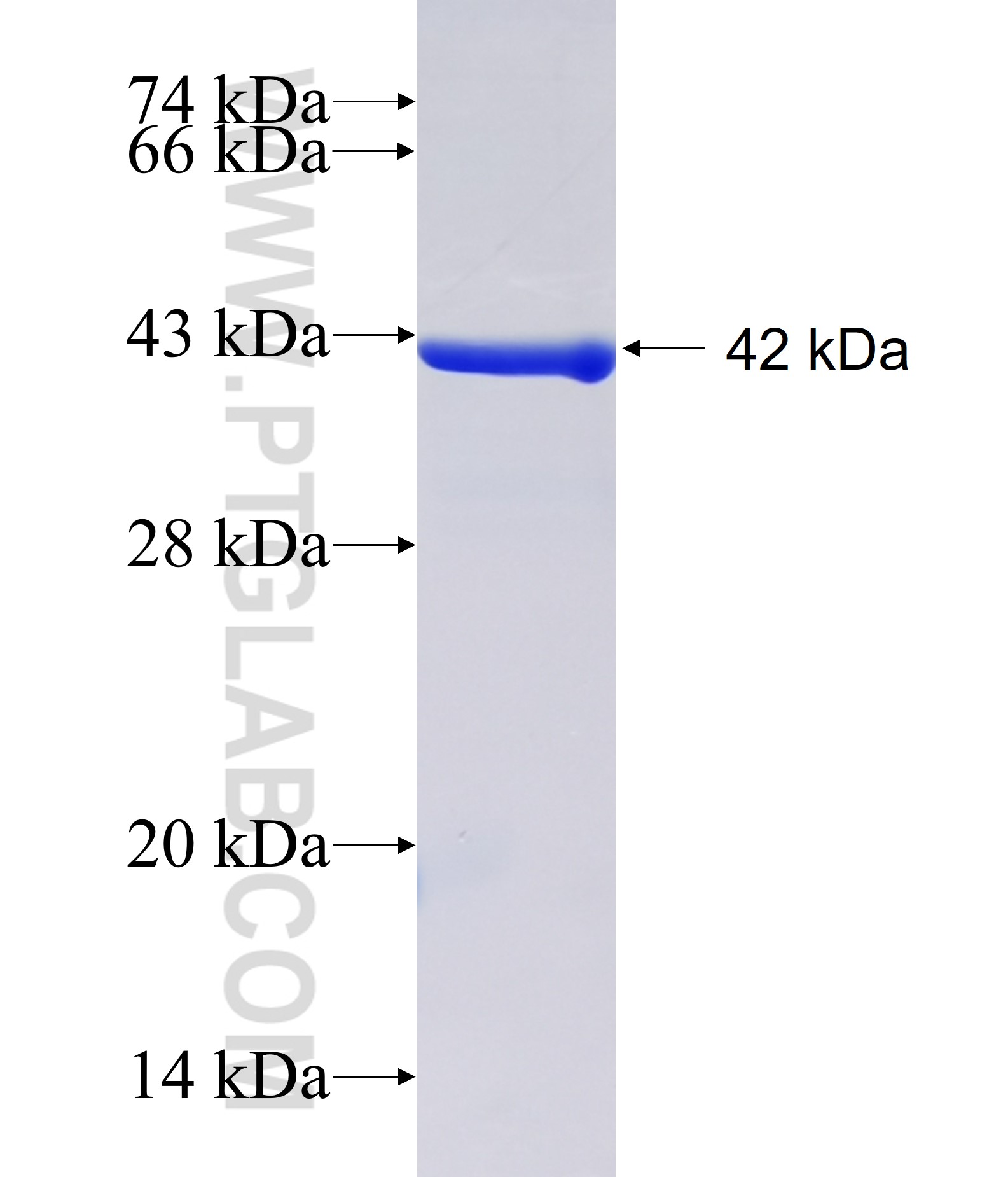 RHOBTB2 fusion protein Ag38531 SDS-PAGE