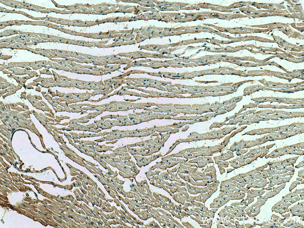 IHC staining of mouse heart using 13945-1-AP