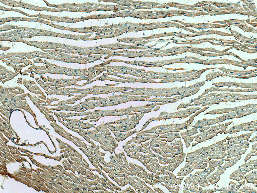 IHC staining of mouse heart using 13945-1-AP