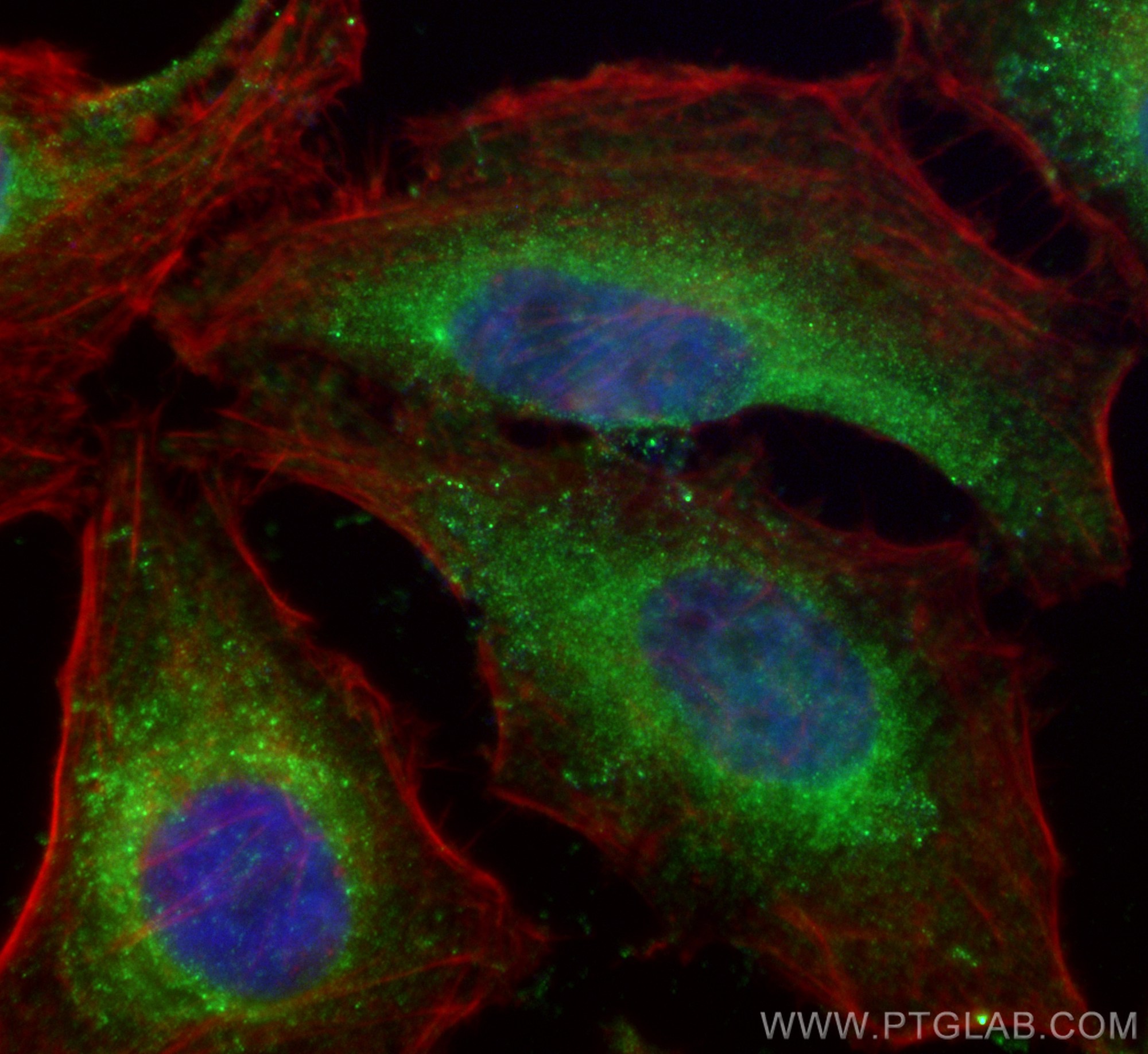 IF Staining of HeLa using 67502-1-Ig