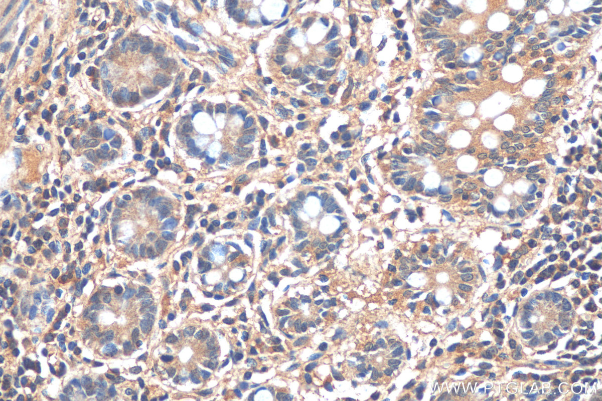 IHC staining of human small intestine using 67542-1-Ig