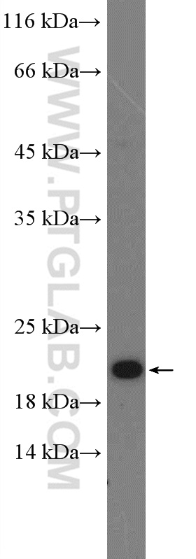 WB analysis of MDA-MB-453s using 19671-1-AP