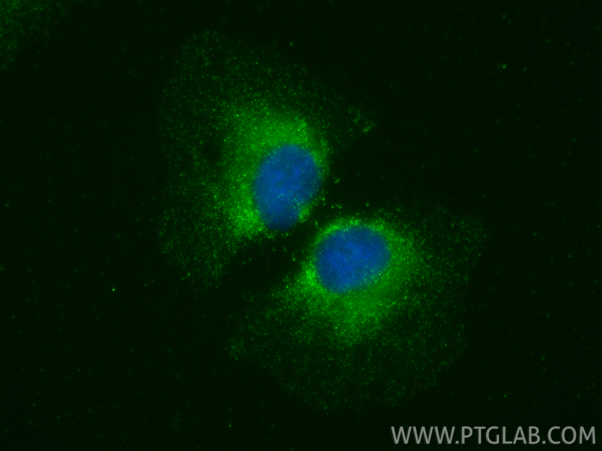 IF Staining of A549 using 27263-1-AP IF Staining of A549 using 27263-1-AP