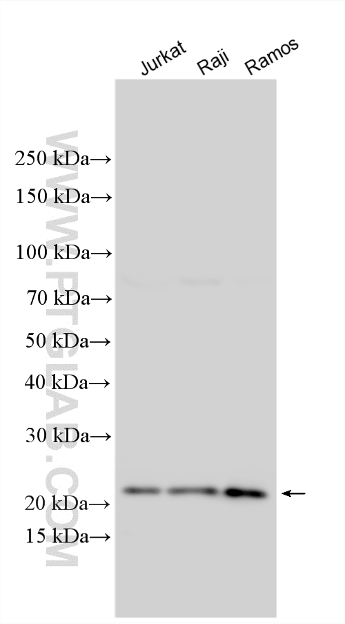 WB analysis using 27263-1-AP (same clone as 27263-1-PBS) WB analysis using 27263-1-AP (same clone as 27263-1-PBS)