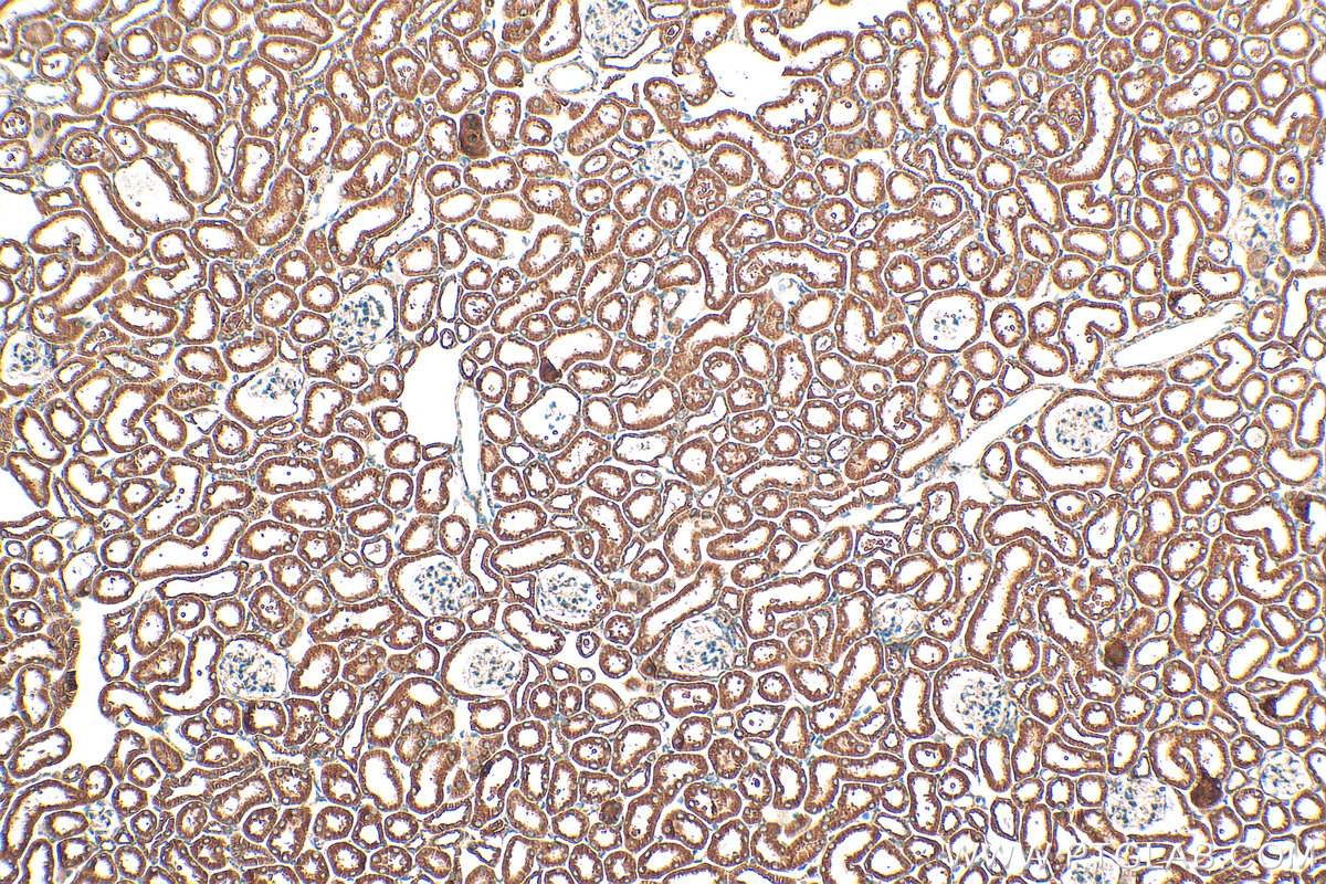IHC staining of mouse kidney using 21560-1-AP
