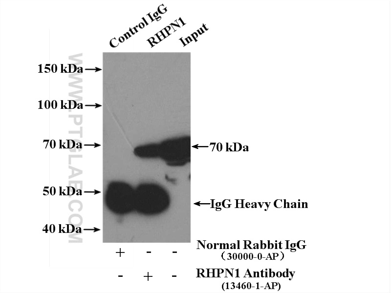 IP experiment of Jurkat using 13460-1-AP