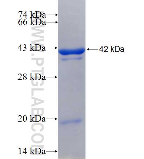 RHPN1 fusion protein Ag25205 SDS-PAGE RHPN1 fusion protein Ag25205 SDS-PAGE