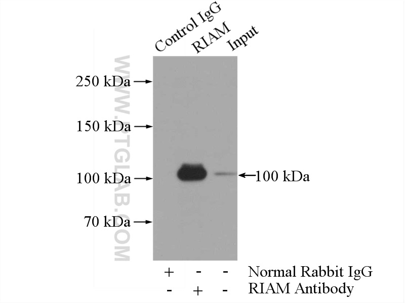 IP experiment of Jurkat using 13500-1-AP