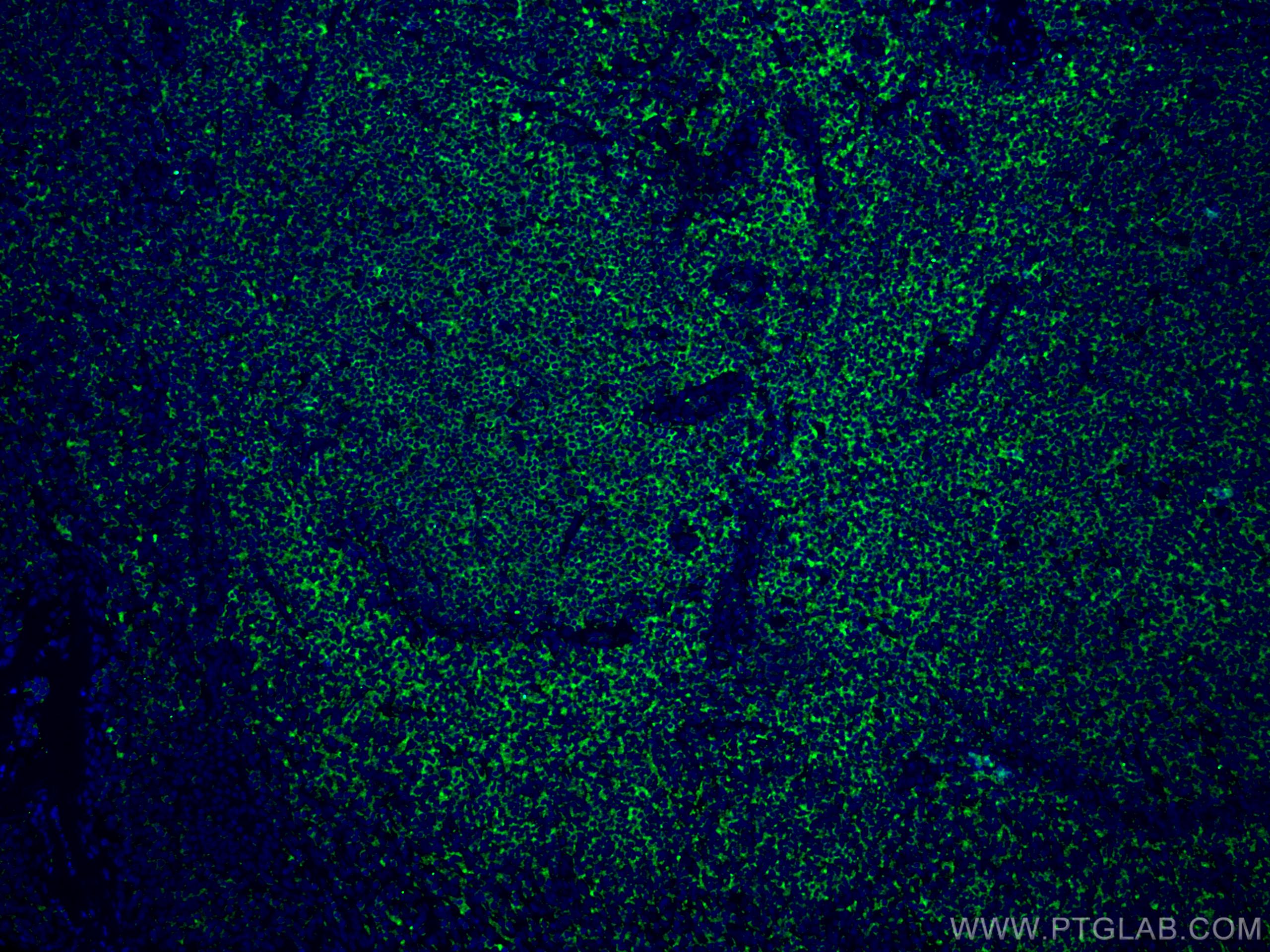 IF Staining of human tonsillitis using 67143-1-Ig (same clone as 67143-1-PBS)