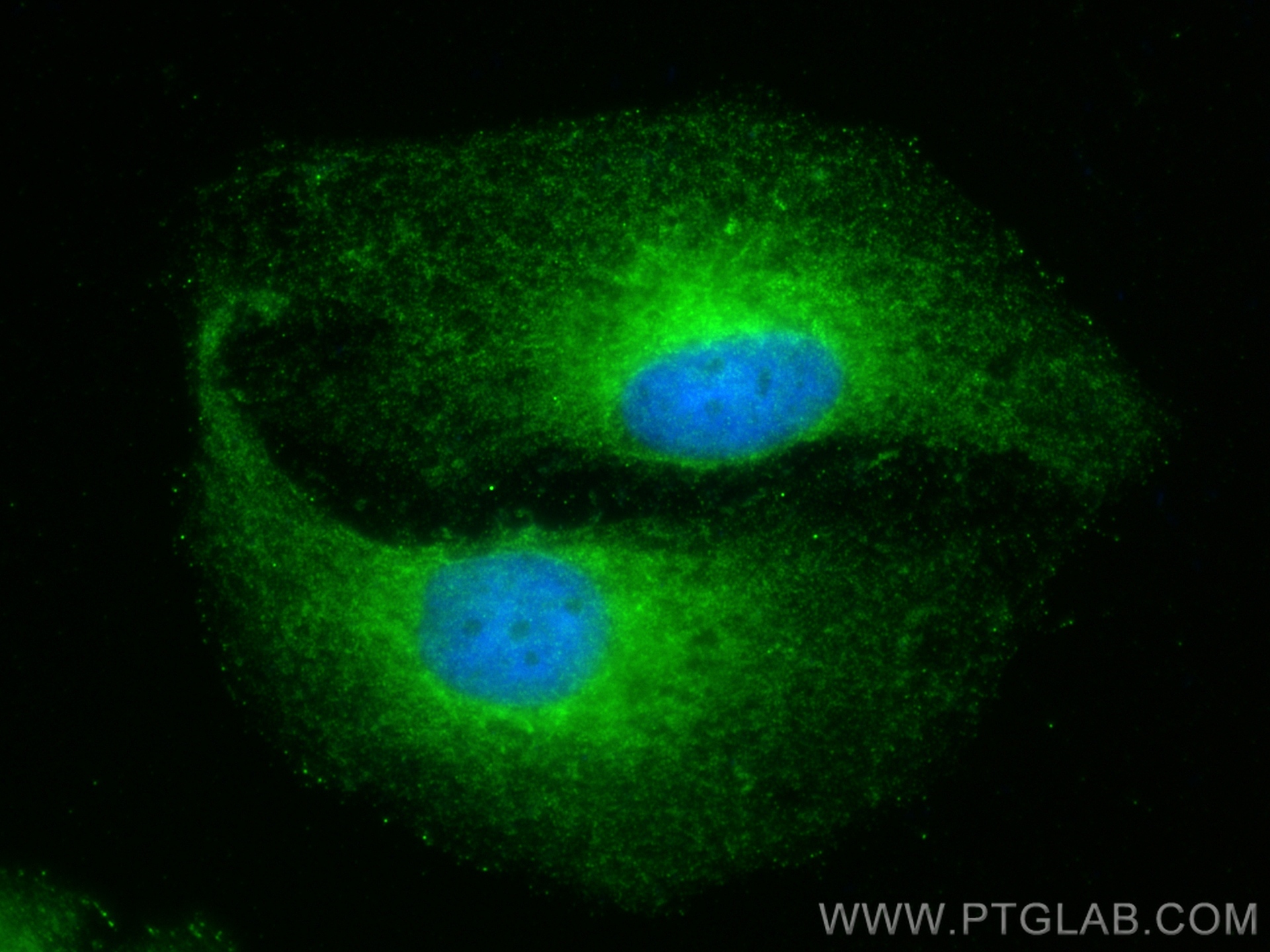 IF Staining of HeLa using 15272-1-AP