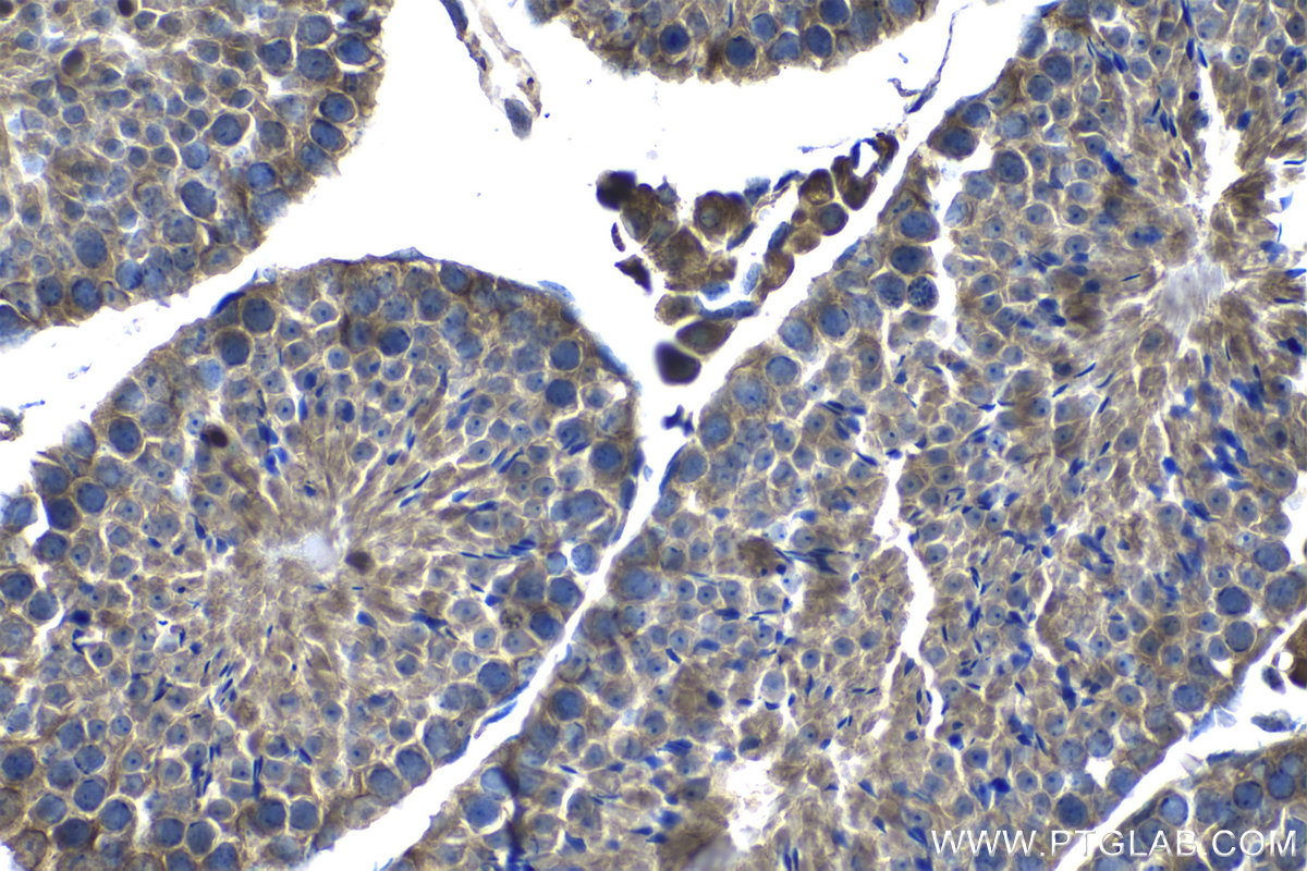 IHC staining of mouse testis using 15272-1-AP