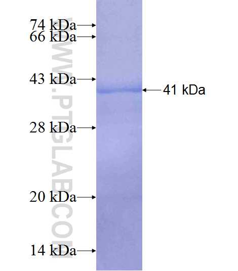 RIBC2 fusion protein Ag7820 SDS-PAGE RIBC2 fusion protein Ag7820 SDS-PAGE