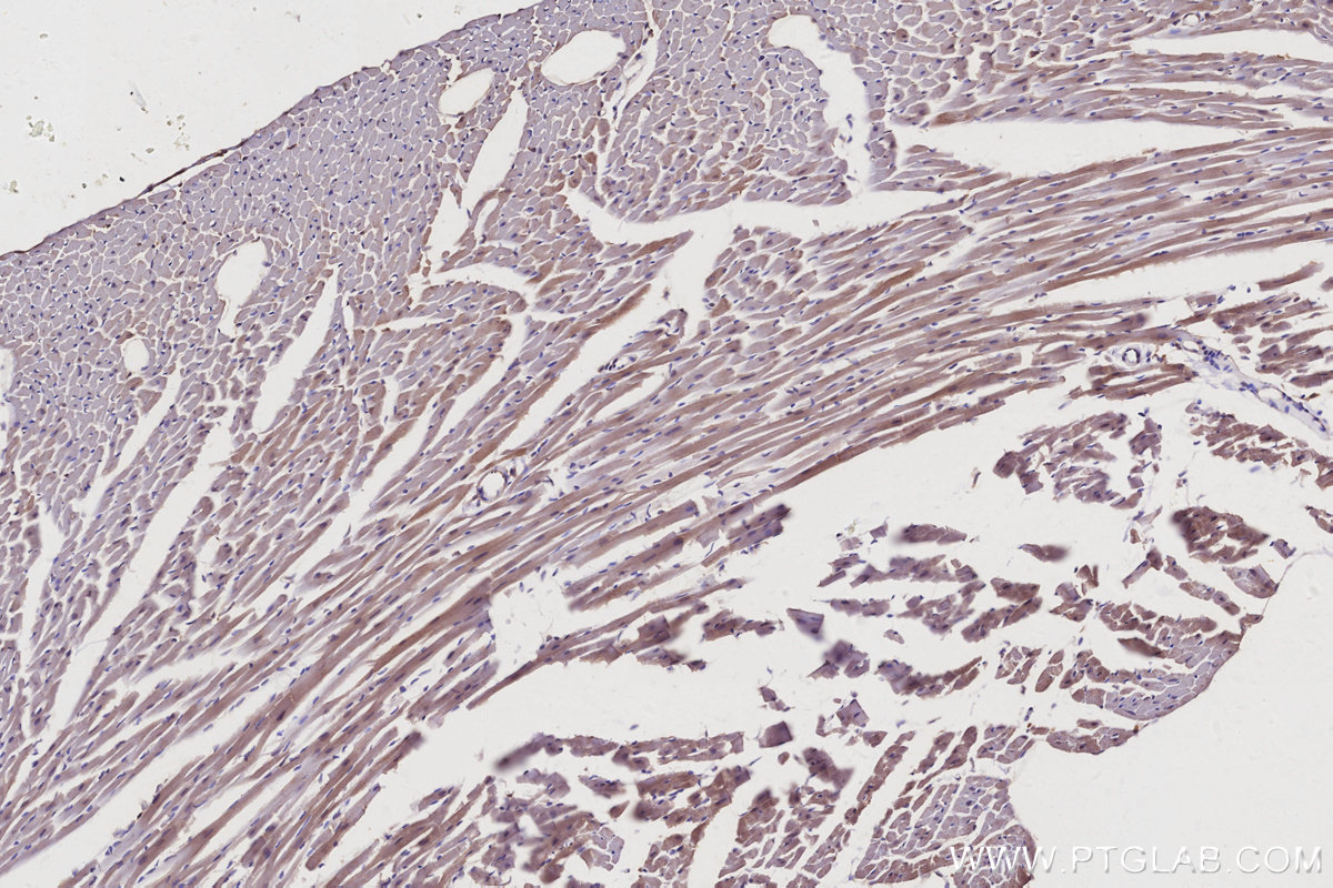 IHC staining of mouse heart using 11138-1-AP IHC staining of mouse heart using 11138-1-AP