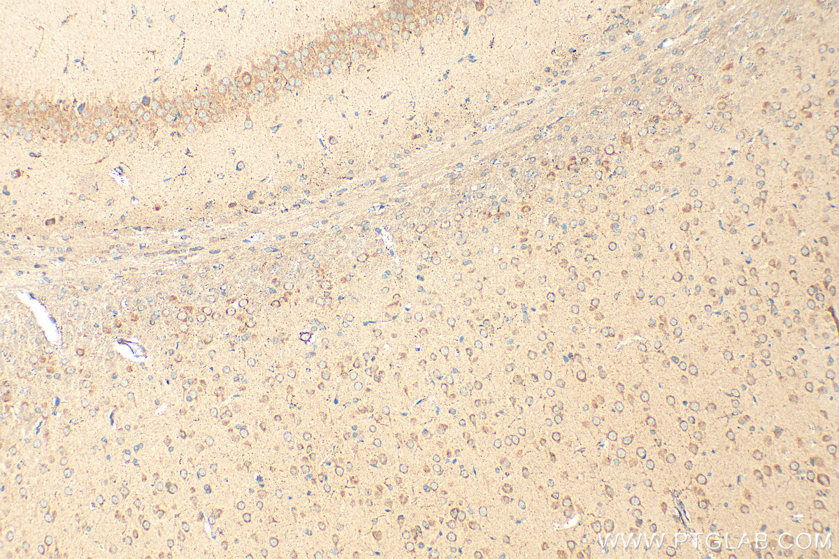 Immunohistochemical analysis of paraffin-embedded rat brain tissue slide using 18707-1-AP (RIC8A antibody) at dilution of 1:200 (under 10x lens). Heat mediated antigen retrieval with Tris-EDTA buffer (pH 9.0). IHC staining of rat brain using 18707-1-AP