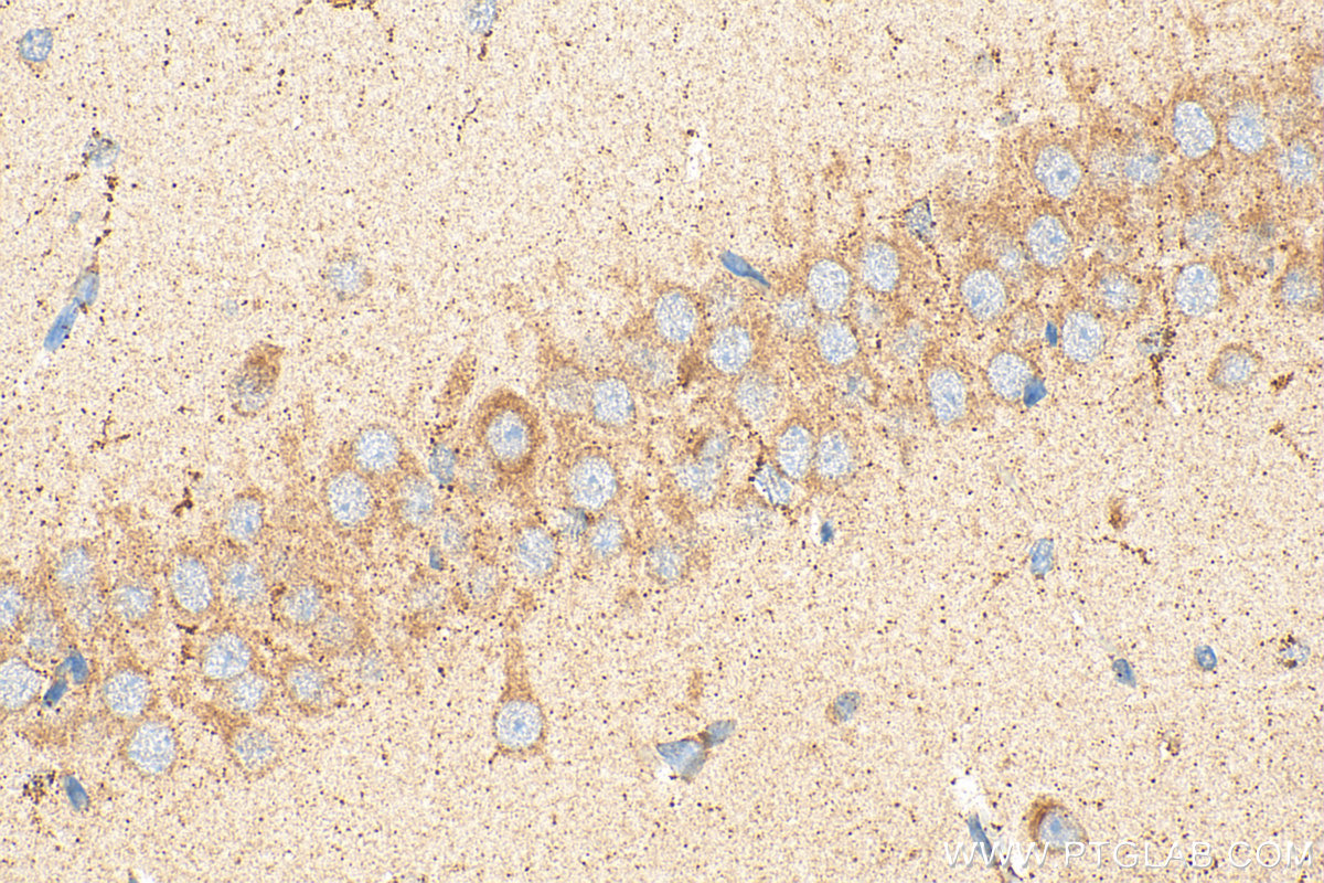 Immunohistochemical analysis of paraffin-embedded rat brain tissue slide using 18707-1-AP (RIC8A antibody) at dilution of 1:200 (under 40x lens). Heat mediated antigen retrieval with Tris-EDTA buffer (pH 9.0). IHC staining of rat brain using 18707-1-AP