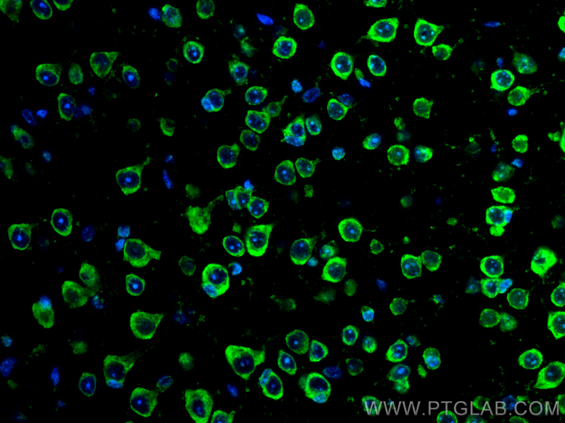 IF Staining of mouse brain using CL488-66625