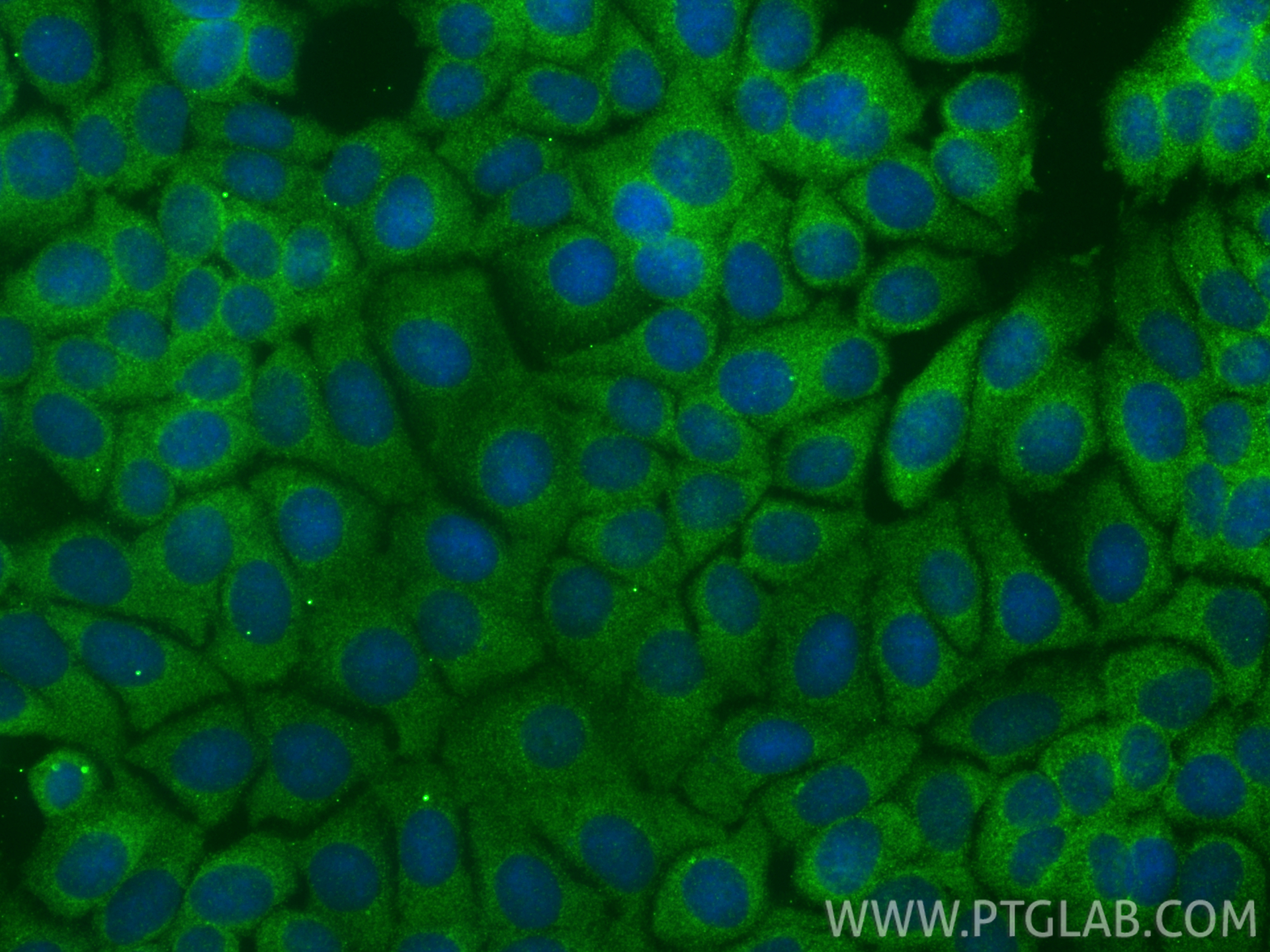 Immunofluorescent analysis of (-20°C Methanol) fixed MCF-7 cells using RIC8B antibody (17790-1-AP) at dilution of 1:400 and CoraLite®488-Conjugated Goat Anti-Rabbit IgG(H+L) (<a class='green' href='/productredirect?CatalogNo=SA00013-2' target='_blank'>SA00013-2</a>). IF Staining of MCF-7 using 17790-1-AP