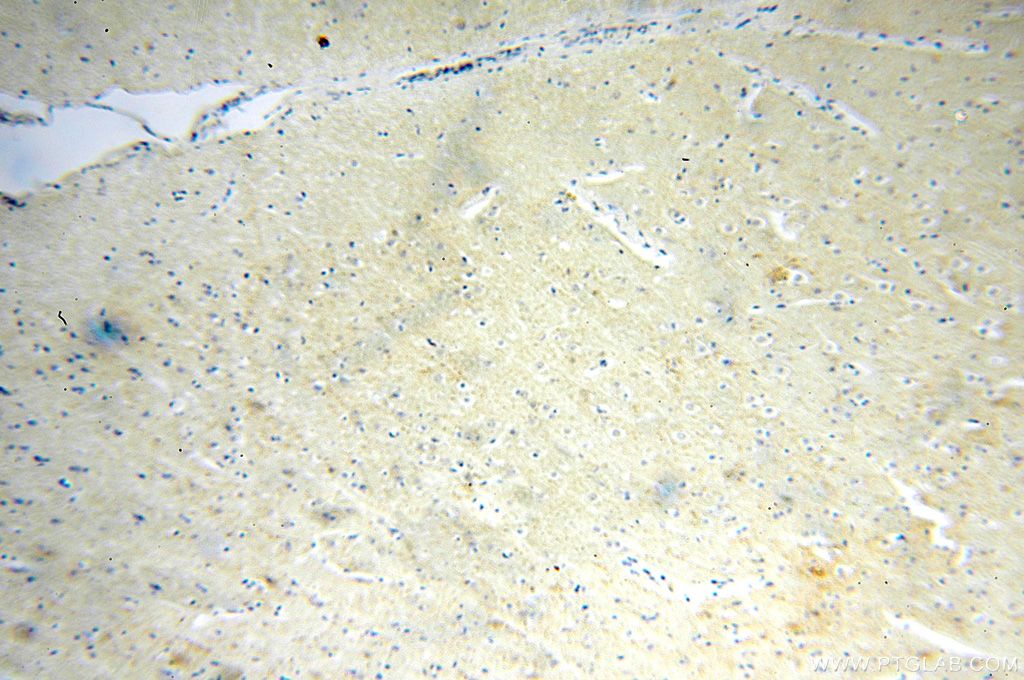 IHC staining of human brain using 17790-1-AP