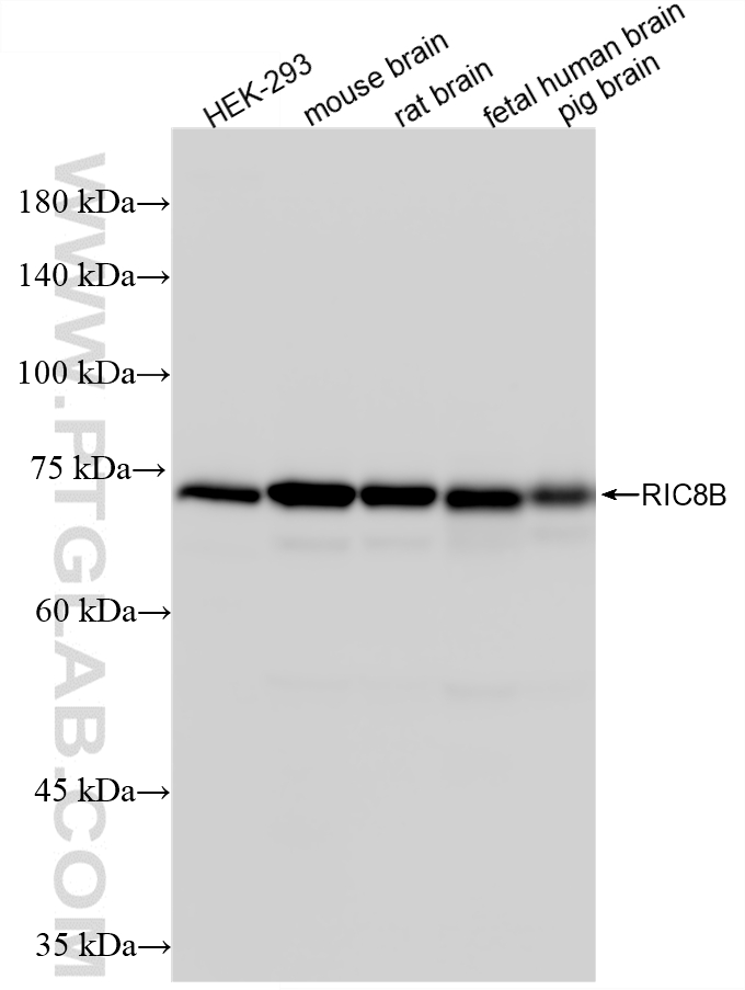 WB analysis using 87524-1-RR (same clone as 87524-1-PBS) WB analysis using 87524-1-RR (same clone as 87524-1-PBS)