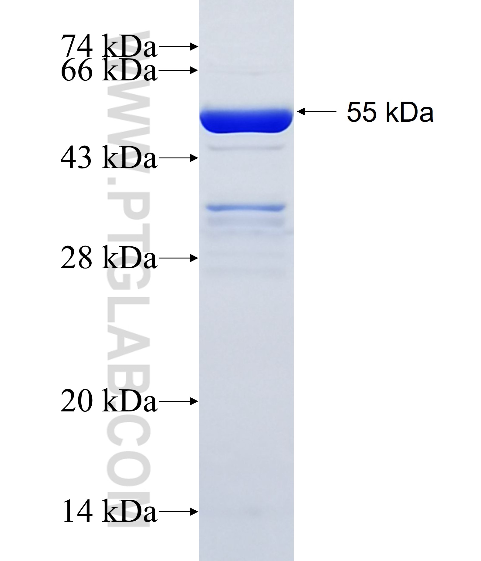 RICS fusion protein Ag35118 SDS-PAGE RICS fusion protein Ag35118 SDS-PAGE
