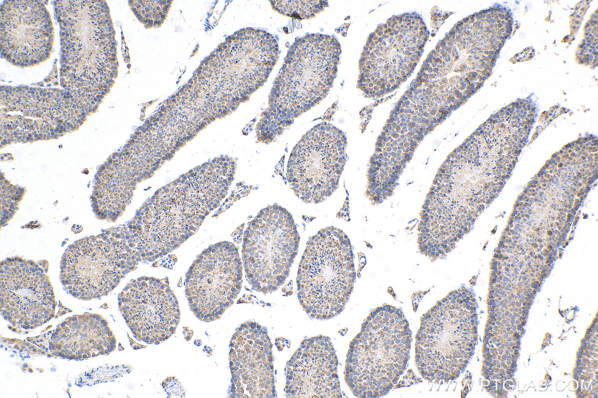 IHC staining of mouse testis using 27248-1-AP