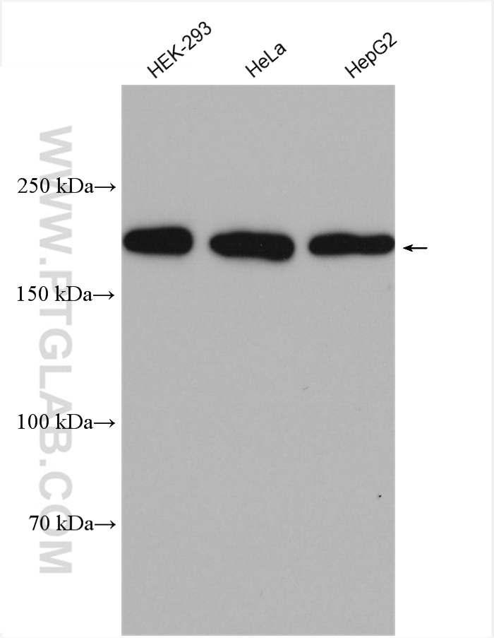 WB analysis using 27248-1-AP