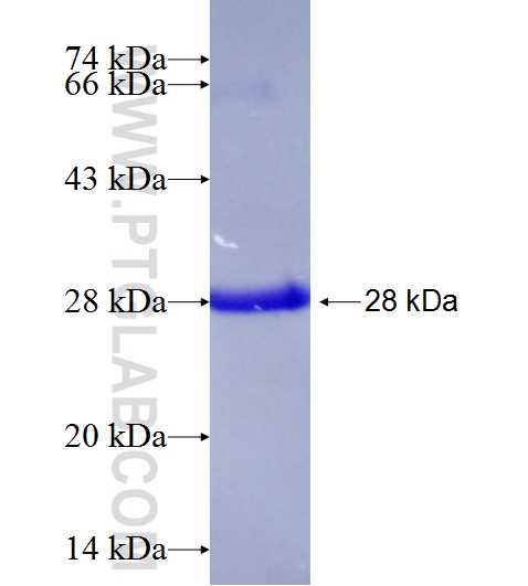 RICTOR fusion protein Ag25248 SDS-PAGE RICTOR fusion protein Ag25248 SDS-PAGE