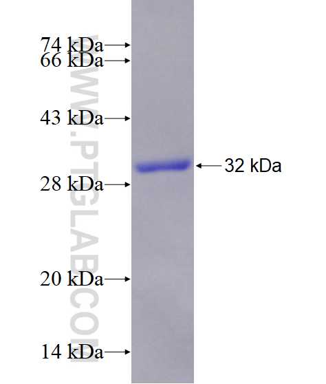 RICTOR fusion protein Ag25649 SDS-PAGE