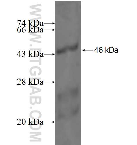RICTOR fusion protein Ag3598 SDS-PAGE RICTOR fusion protein Ag3598 SDS-PAGE