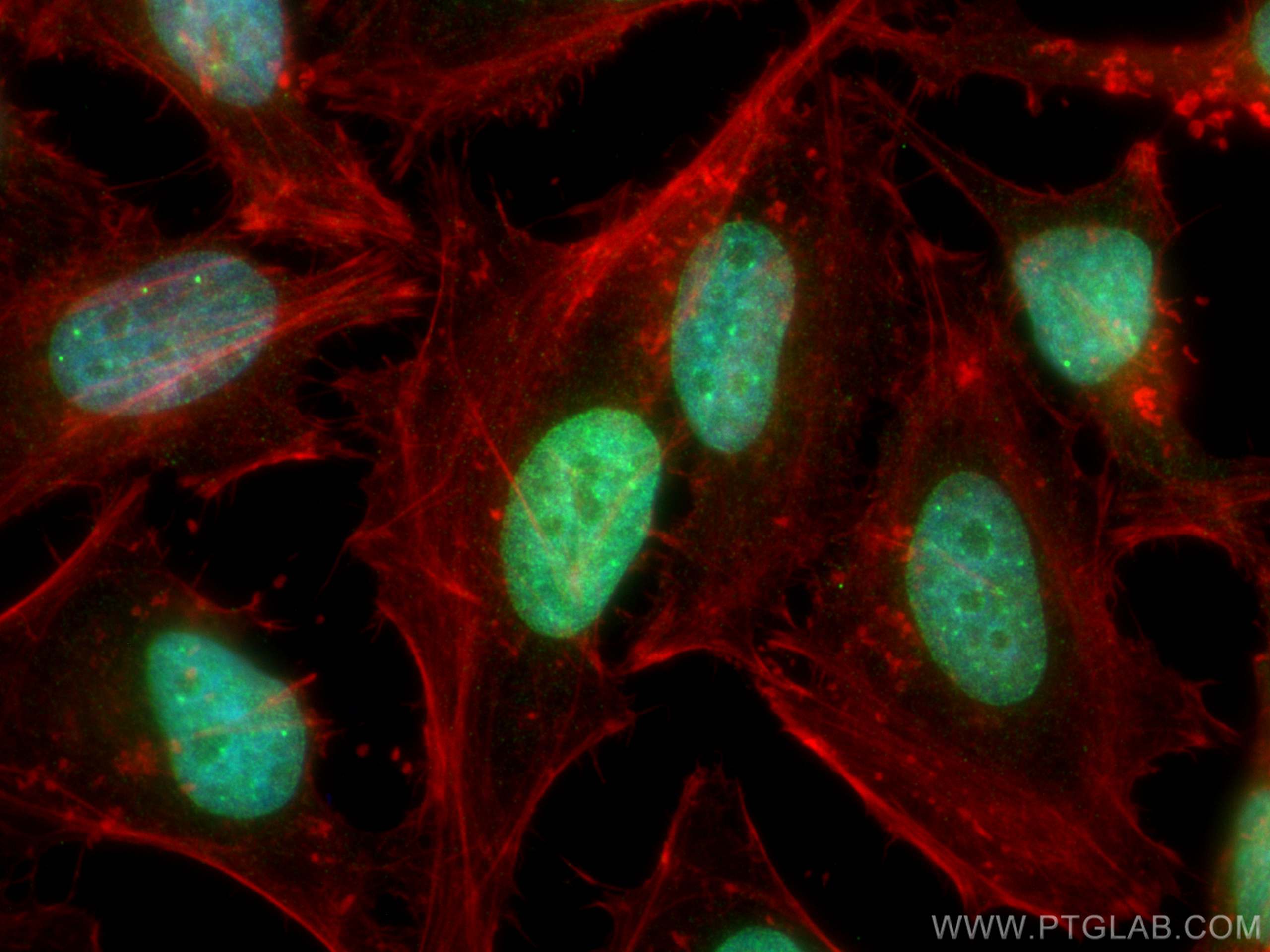 IF Staining of HeLa using 30119-1-AP