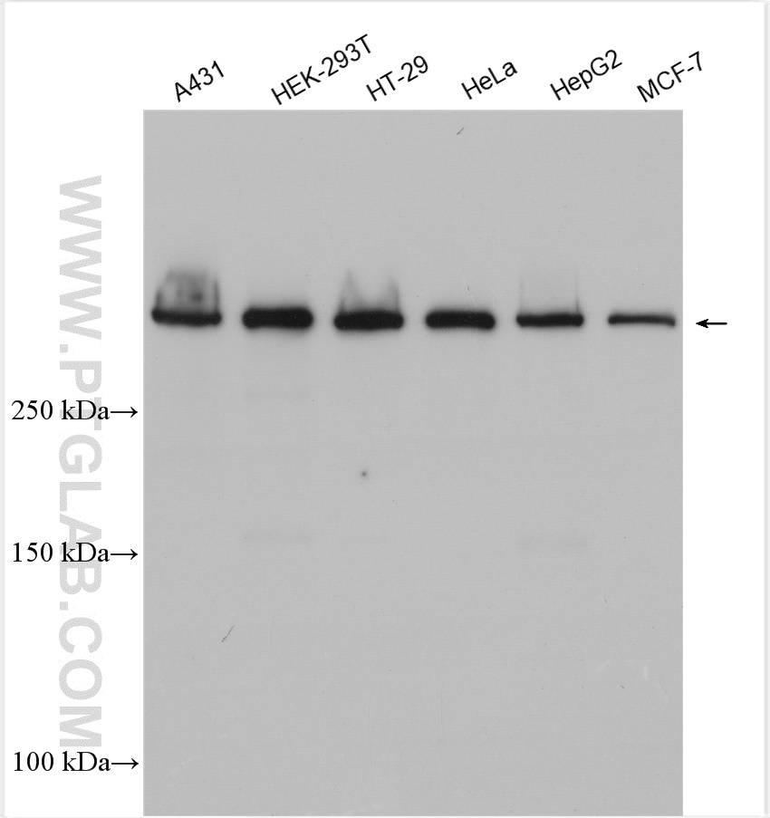 WB analysis using 30119-1-AP