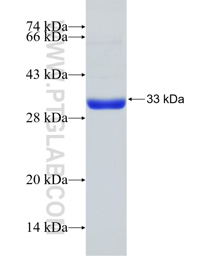 RIF1 fusion protein Ag32396 SDS-PAGE RIF1 fusion protein Ag32396 SDS-PAGE