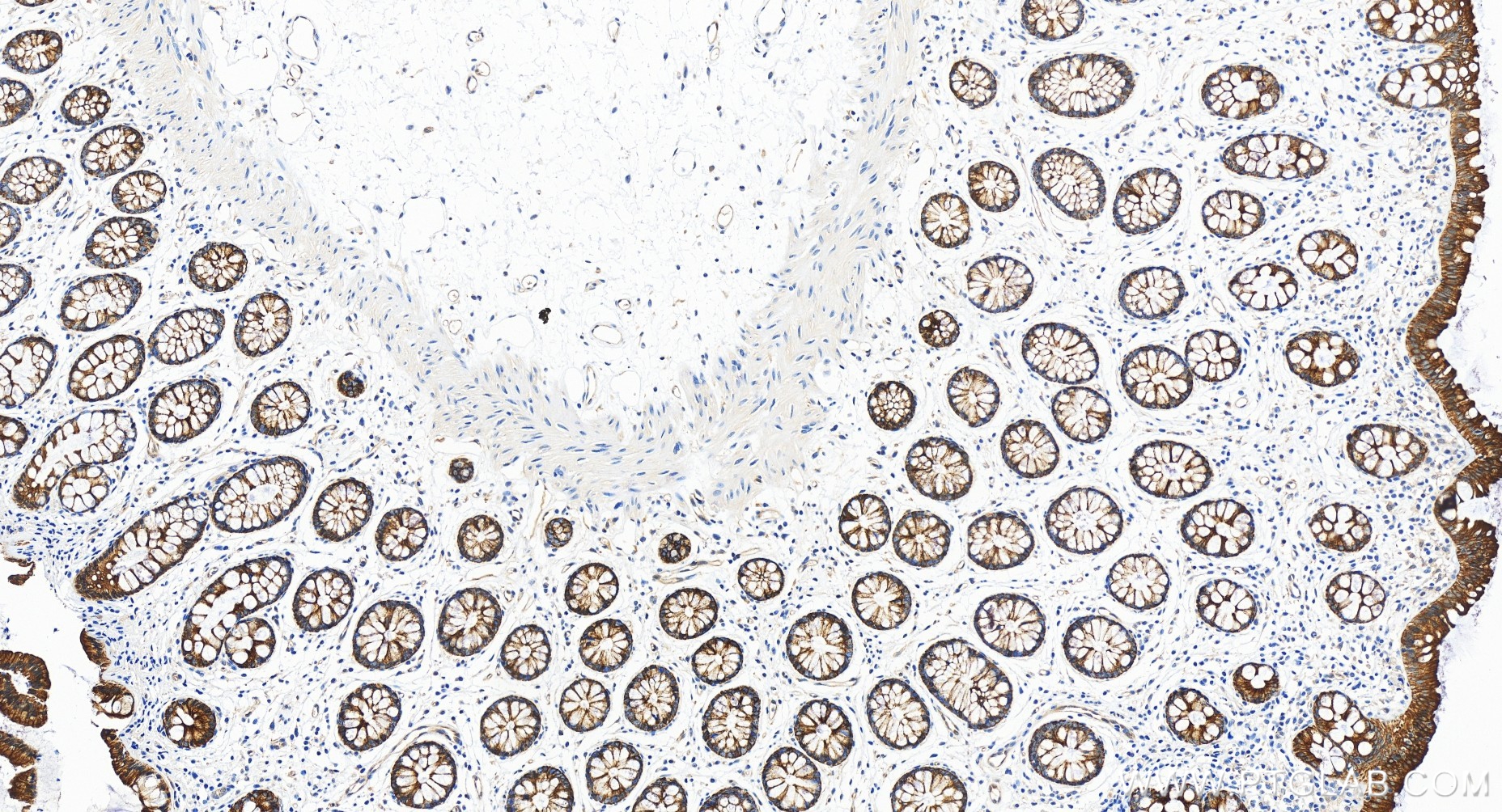 IHC staining of human colon using 84861-5-RR (same clone as 84861-5-PBS)