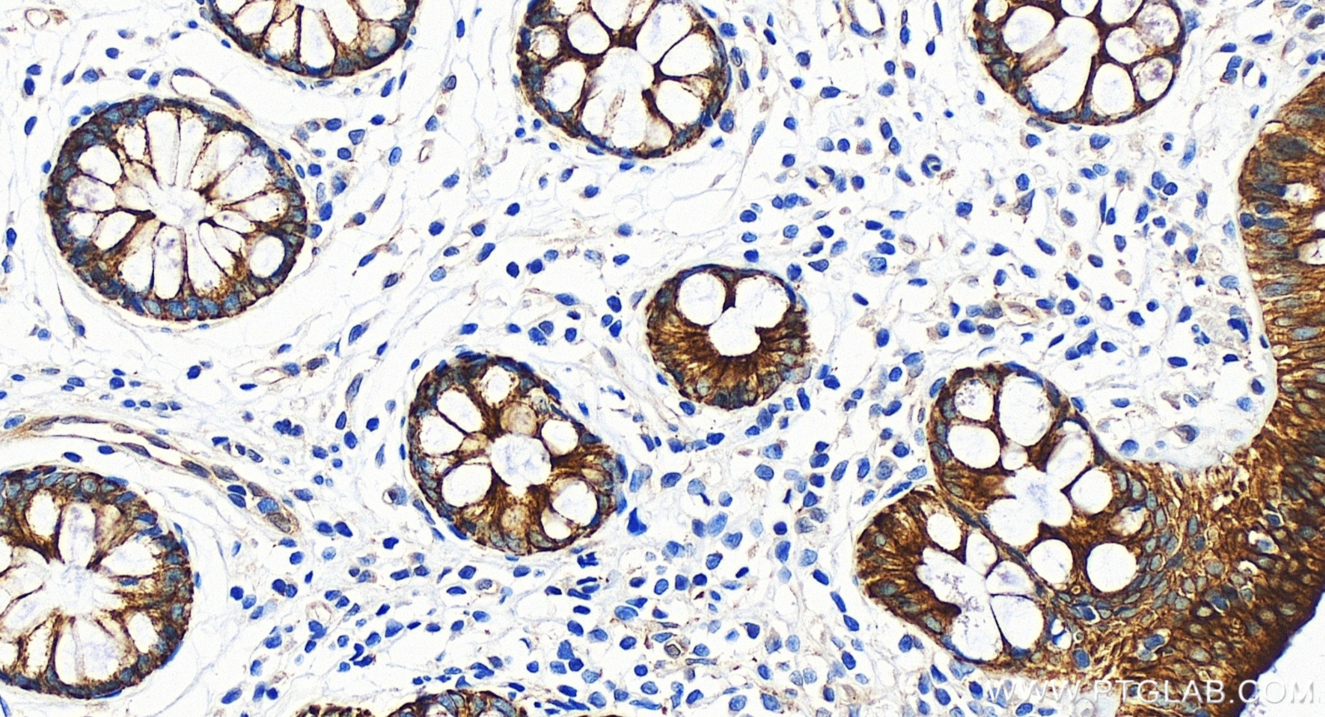 IHC staining of human colon using 84861-5-RR (same clone as 84861-5-PBS)