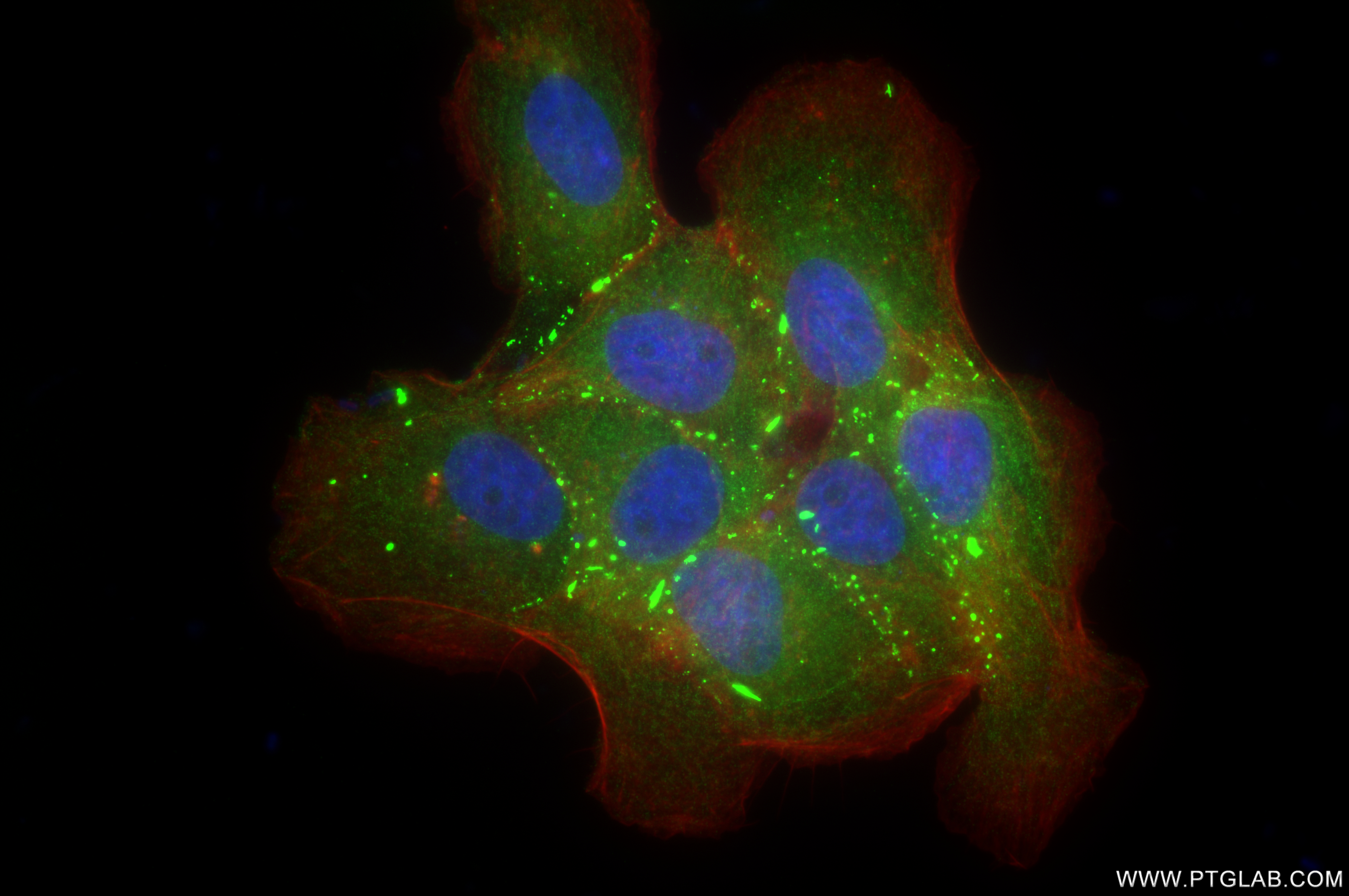 IF Staining of A431 using 84861-5-RR (same clone as 84861-5-PBS)