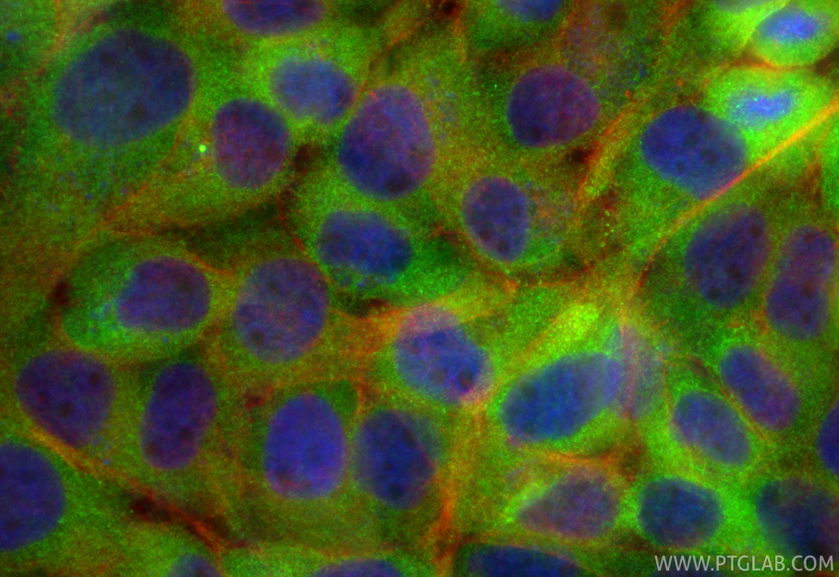 Immunofluorescent analysis of (4% PFA) fixed A431 cells using CoraLite® Plus 488 RIG-1/DDX58 antibody (CL488-84861-5, Clone: 242424E7 ) at dilution of 1:200, CL594-Phalloidin (red). IF Staining of A431 using CL488-84861-5