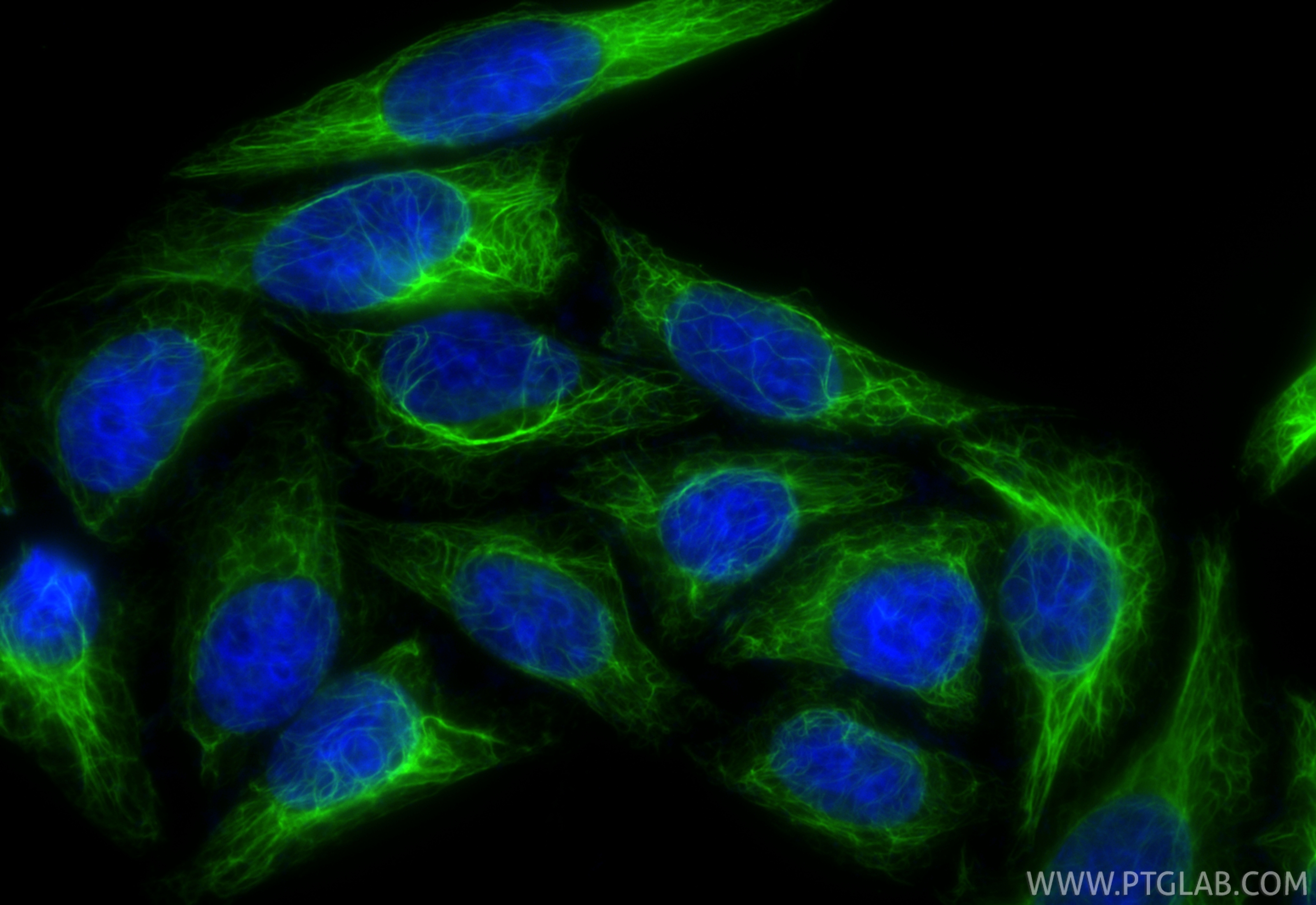 Immunofluorescent analysis of (-20°C Ethanol) fixed HepG2 cells using CoraLite® Plus 488 RIG-1/DDX58 antibody (CL488-84861-5, Clone: 242424E7 ) at dilution of 1:200. IF Staining of HepG2 using CL488-84861-5