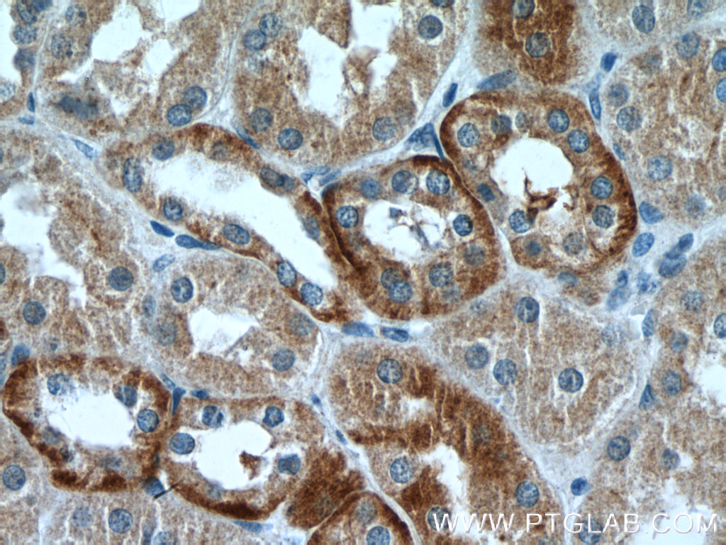 IHC staining of human kidney using 13574-1-AP