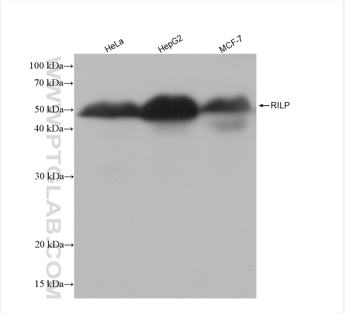 WB analysis using 82996-4-RR