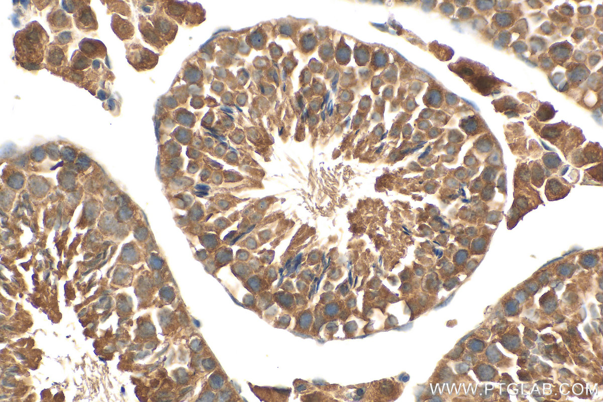 IHC staining of mouse testis using 26111-1-AP