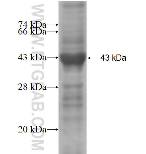 RIMS2 fusion protein Ag5018 SDS-PAGE RIMS2 fusion protein Ag5018 SDS-PAGE