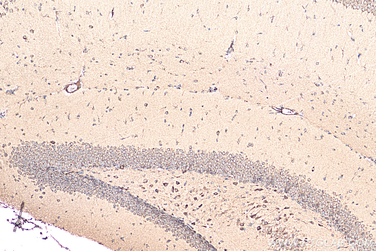IHC staining of mouse brain using 20093-1-AP