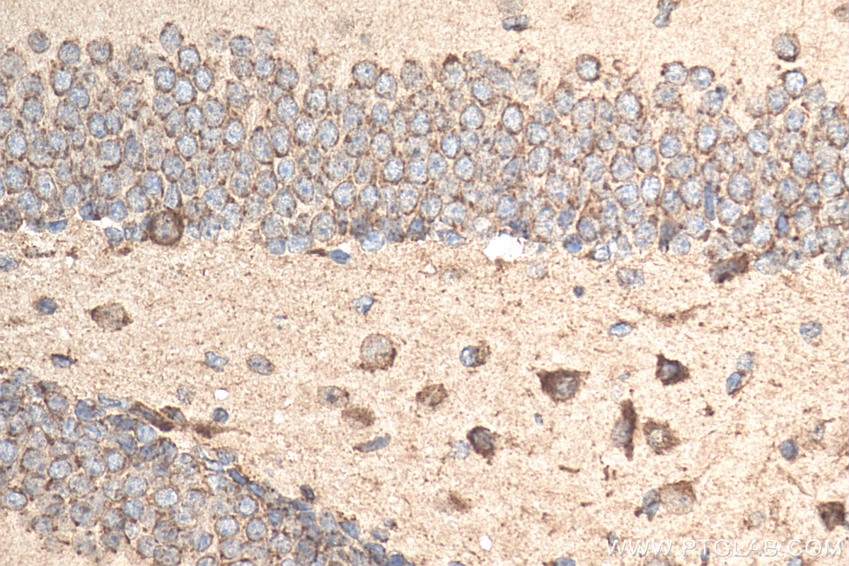 IHC staining of mouse brain using 20093-1-AP