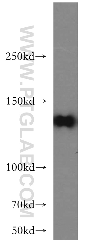 WB analysis of L02 using 20093-1-AP