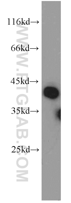 WB analysis of HL-60 using 15088-1-AP