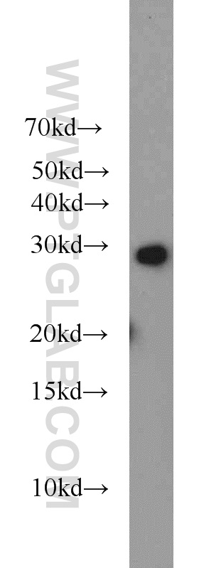 WB analysis of mouse brain using 20091-1-AP