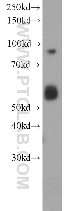 WB analysis of HeLa using 16388-1-AP